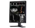 NEC 21IN WS LCD COLOR 750:1 3MP 2048X1536 MEDICAL DVI BLK PORTRAIT