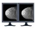 NEC TWO 20.1IN 5MP 3061 2536X2048 MDM-XENPRO GRAY